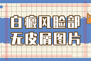 脖子上有白色斑塊是什么原因？白癜風(fēng)誘發(fā)原因做什么檢查-得白癜風(fēng)的概率